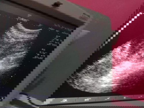 Brp usia kandungan saya