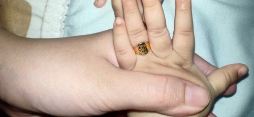 CAMPAK, BABYKU 14 month