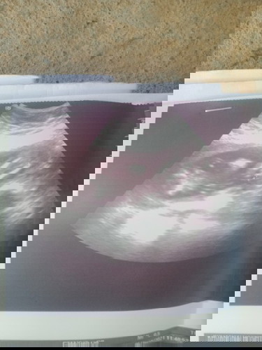 แบบนี้ผู้หญิงหรือผู้ชาย