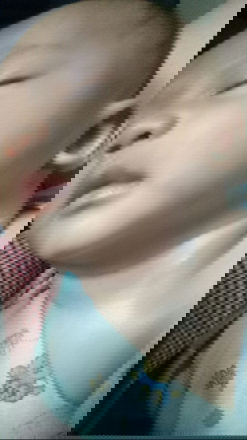 Apakah ada anak bunda yang mengalami Tortikolis?