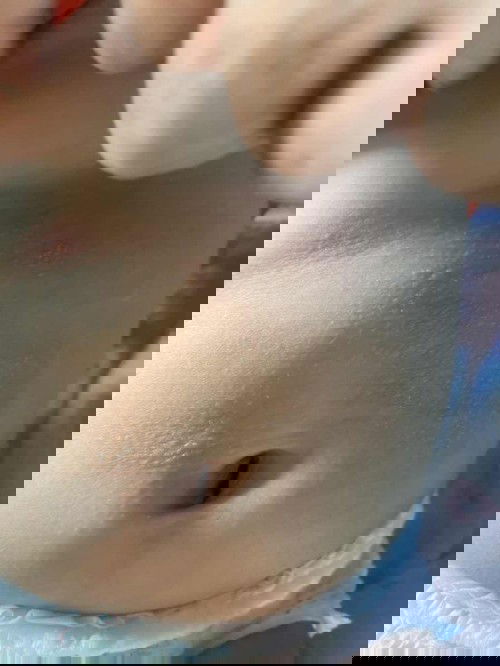 ผดผื่นขึ้นหน้าท้องแก้ไขยังไงกันคะ