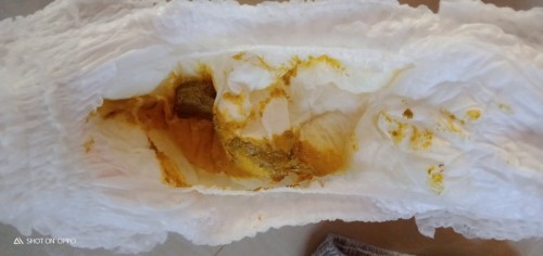 ทำไมลูกอึเป็นแบบนี้?