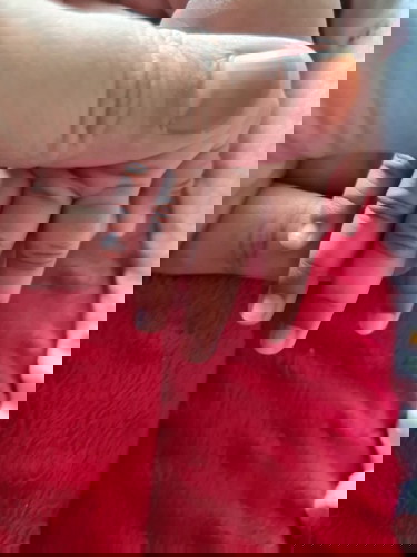 Hi mommies..
Baby ms umur 1 bulan kelihatan kulit sekitar ruas jari kehitaman.kenapa? Boleh hilang?