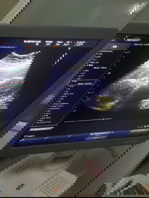 ดูยังไงค่ะ