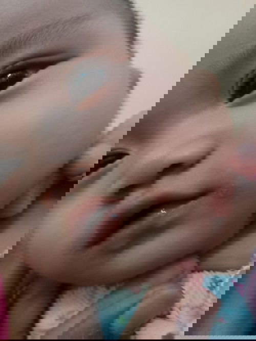 เหมือนที่ปากลูกจะเป็นโรคเริมค่ะน้อง 6 เดือน