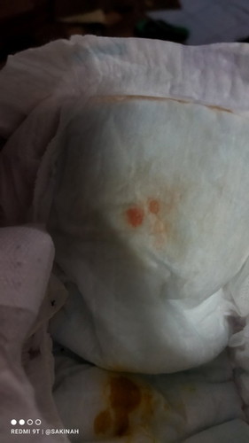 Assalamualaikum  ...nak tanya anak Sya baru 4 bulan ...tapi kenapa air kencing ank Sya warna oren?