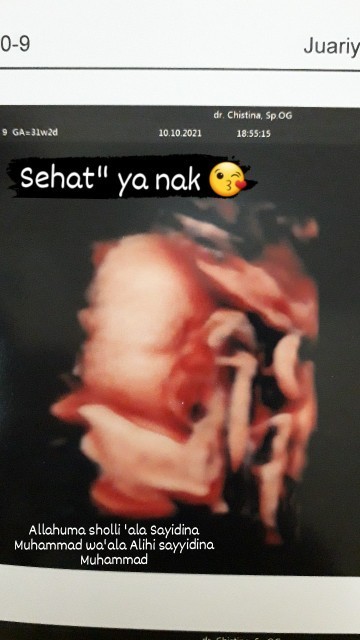 Berat badanya kecil kata dokter