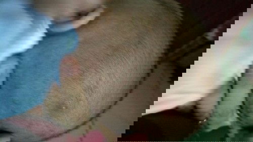 jerawat / bisul di kepala bayi