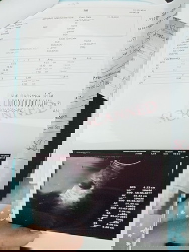 สอบถามแม่ๆหน่อยค่ะ ช่วยดูให้หน่อยว่าอายุครรภ์ ตอนนี้เท่าไรแล้วคะ พอดีแม่จำประจำเดือนไม่ได้ หมอคำนวนแ