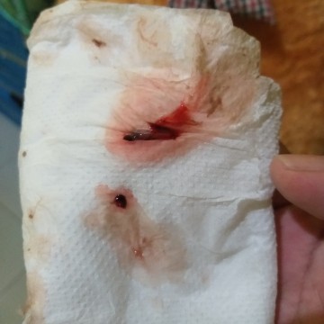 Sana po my makasagot sa post ko kung mucosplug na po ba ito