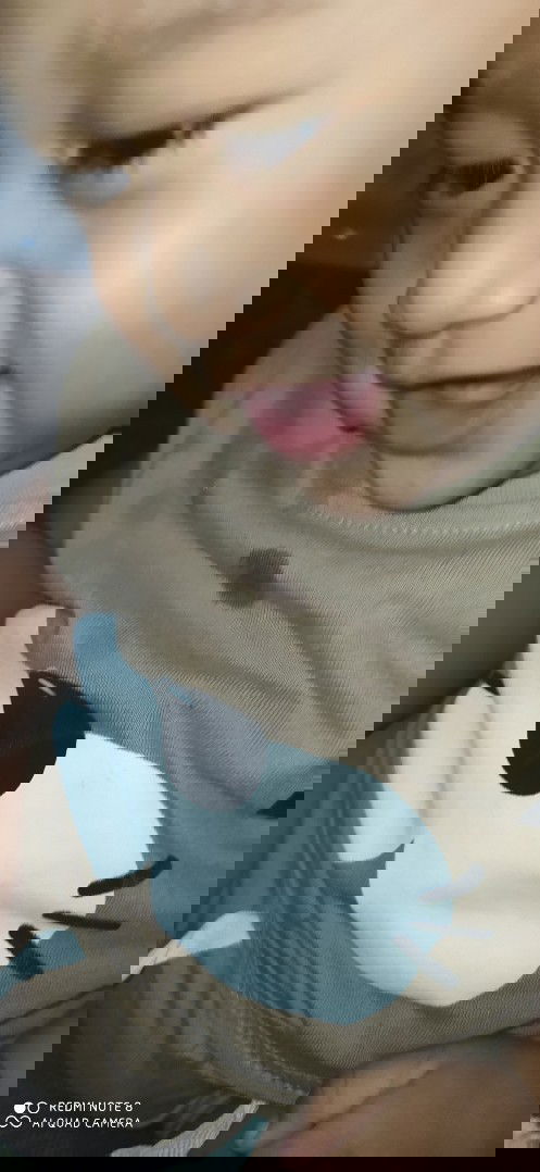 Usia 10 bulan belum muncul gigi nya