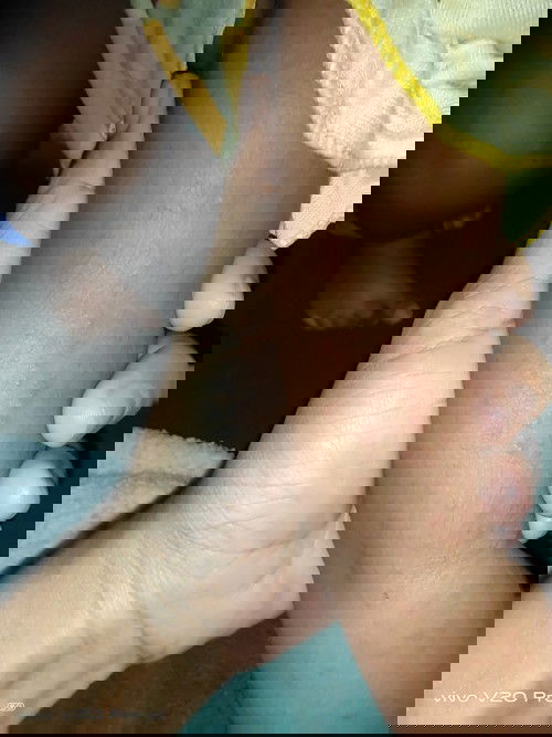 มีตุ่มขึ้น