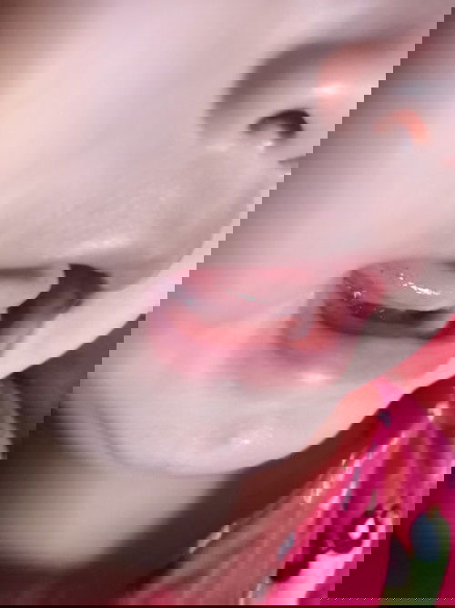 Lưỡi bé bị nổi chấm đỏ