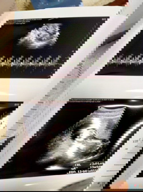 13Week ทีมเมษาจ้า ?? ตื่นเต้นมากๆเลยค่ะ
#ท้องแรก