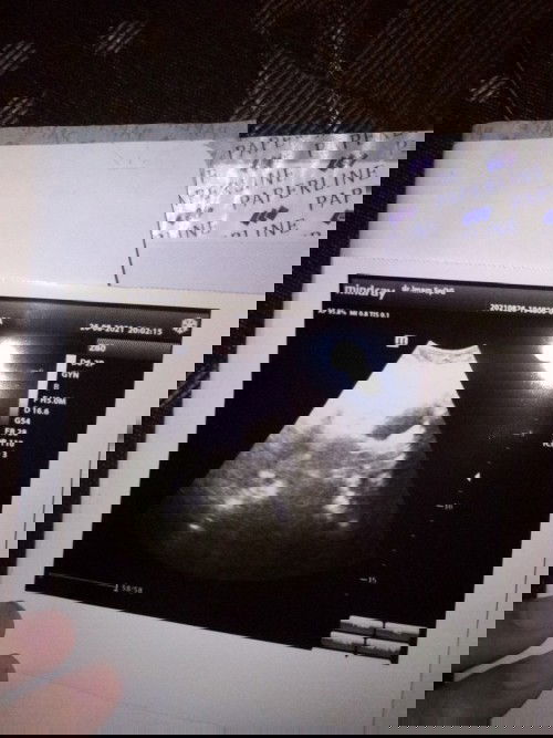 Merencanakan kehamilan