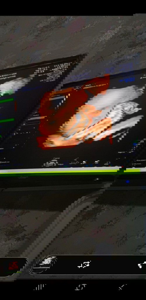 Ketuban sedikit, adakah yang sama?