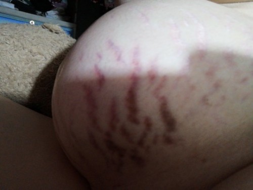 Removing stretch that's effective please :(