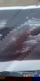 สอบถามเพิ่มเติม