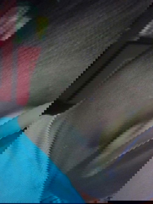 benjolan di blakang telinga