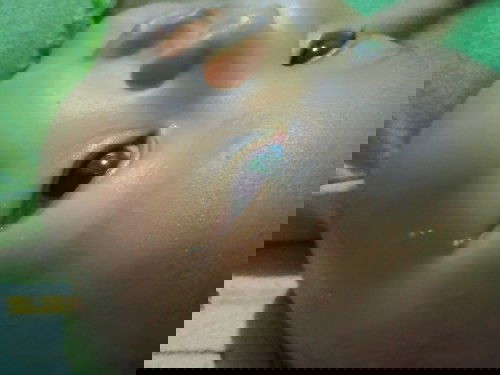 Cara menghilangkan bintik putih di wajah