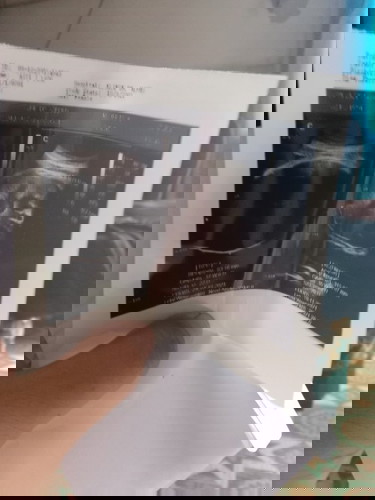 Alhamdulillah hasil USG nya baik semua π₯° Alhamdulillah jenis kelaminnya laki laki