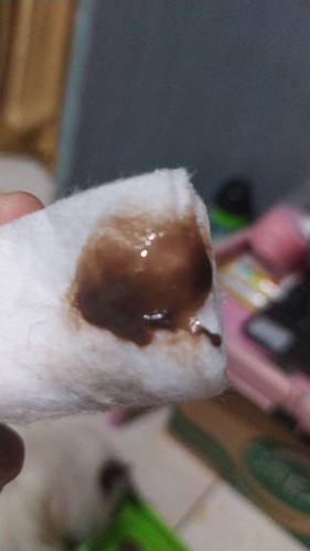 Mau tanya nih, kalau keluar lendir coklat gtu tandanya kenapa ya?