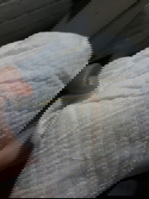 Bun mau tanya anak saya kalau pipis ada bercak pink, itu kenapa ya? pipisnya jg sedikit.