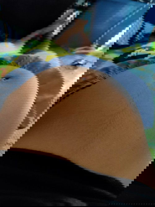 ท้องปั้นเป็นอะไรมั้ย