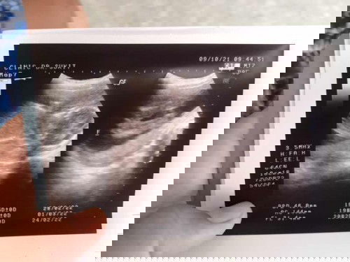 แม่ๆคะดูยังไงว่าเป็นเพศไหนค่ะ