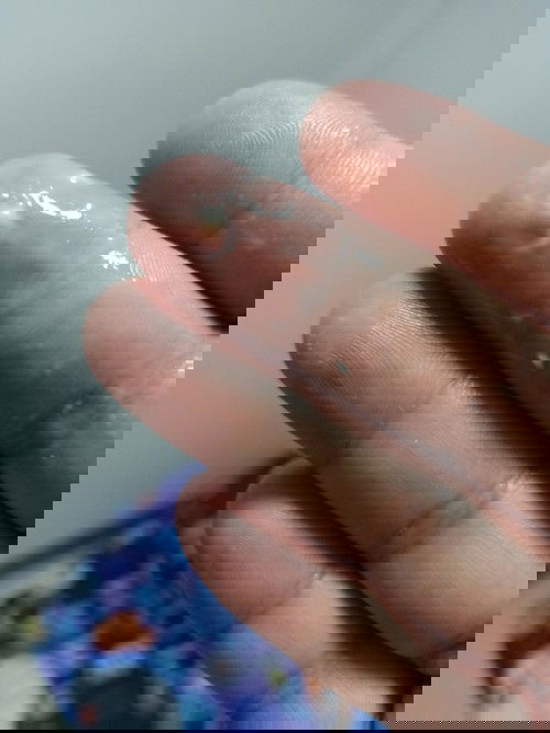 สอบถามแม่ๆหน่อยใกล้จะคลอดแล้วมีตกขาวแบบนี้เป็นอะไรมั้ยค่ะไม่มีกลิ่นไม่คัน