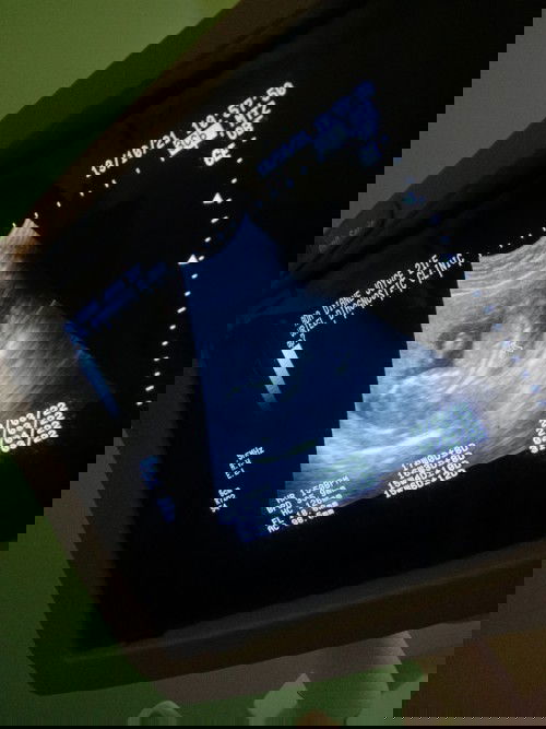 How many weeks? Or kita naba ang Gender?