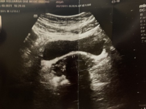 Upt positif scan tak nampak