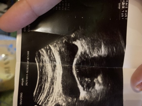 Upt makin terang scan tak nampak