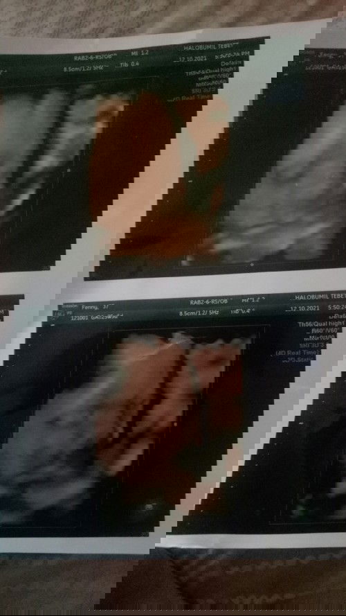 Tetap bersyukur intinya