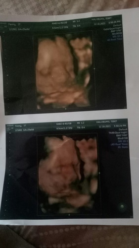 Tetap bersyukur intinya