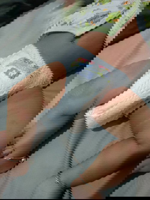 สอบถาม เรื่องลมพิษ