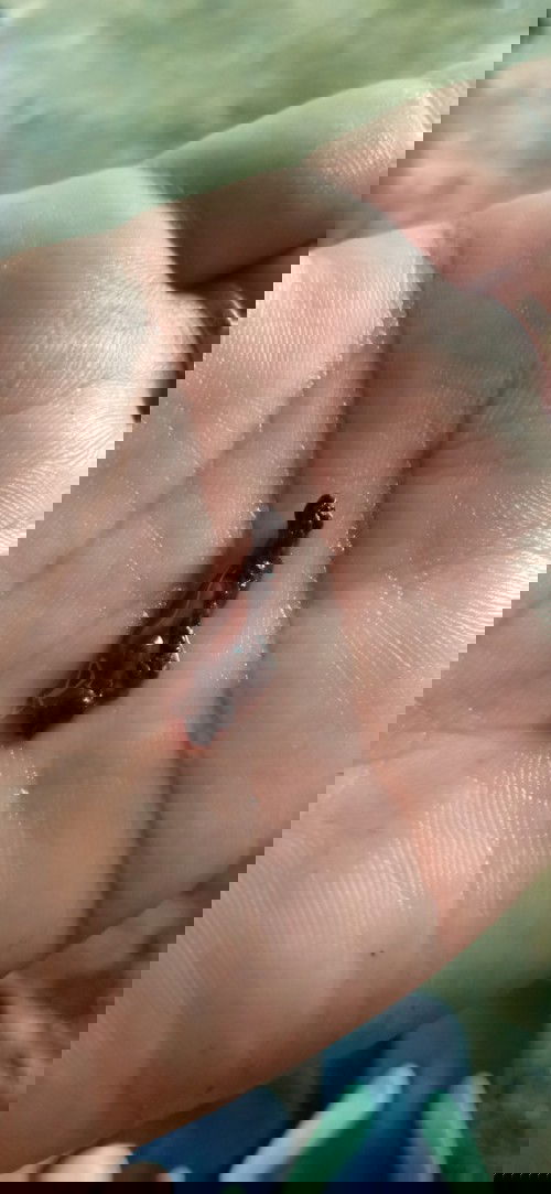 Flek cokelat saat hamil 11 minggu