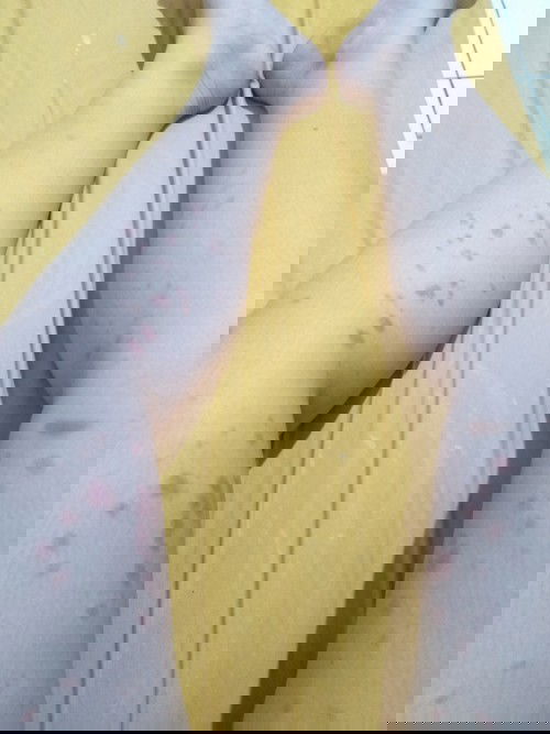 Cara ngilangin puppp