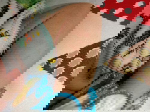 Bintik-bintik merah dan berair pada kulit bayi