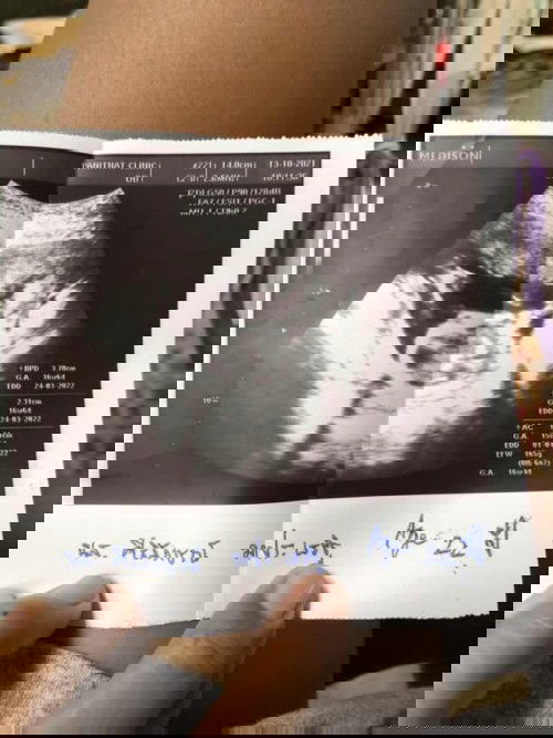 ความยาวของลูก