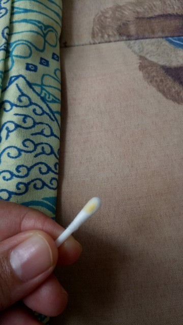 Cairan dari payudara