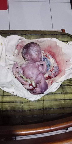 Pag  6 to 7 mos nanganak at normal delvery. Pro lana buhay bb . niraraspa agad ba with 3 or 5 days?