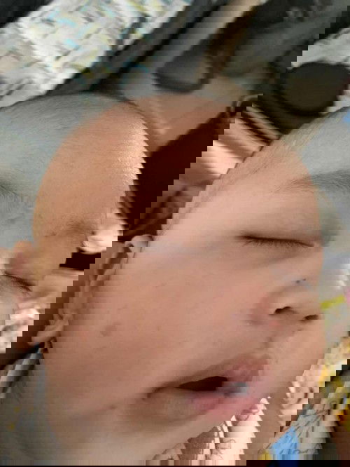 Bayi 4 bulan muncul bintik2 kecoklatan