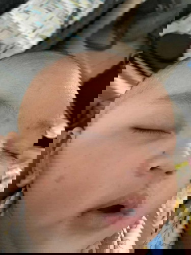 Bayi 4 bulan muncul bintik2 kecoklatan