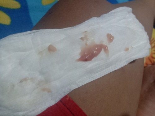 Hello Mga KaMommy☺️ May Tanong Lang Po Ako,