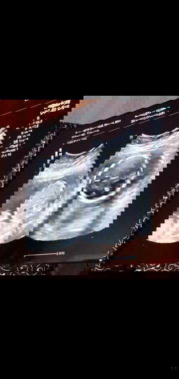 jenis kelamin? mohon dijawab