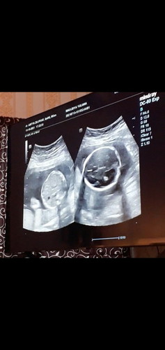 jenis kelamin? mohon dijawab