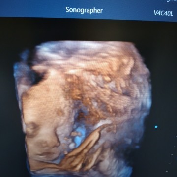 First pregnant