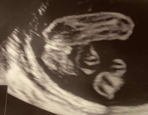 Scan gender
