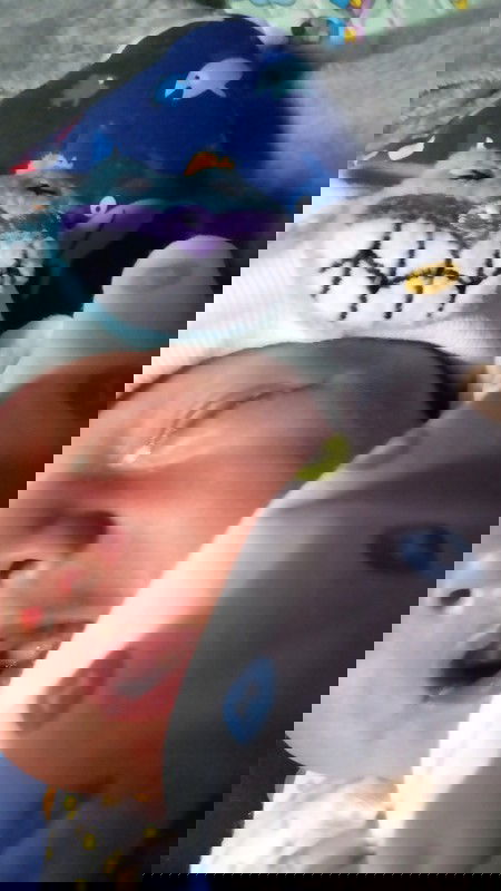 Baby 14 hari beleken